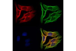 ABIN6262116 and ABIN6273047 staining Hela cells by IF/ICC. (GSTA4 anticorps  (N-Term))