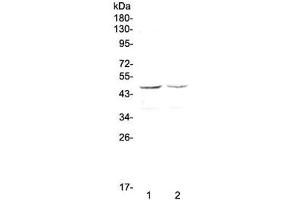 Western blot testing of human 1) HepG2 and 2) MCF7 cell lysate with GALT antibody at 0. (GALT anticorps)