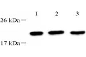 Western blot analysis of TPPP3 (ABIN7076047),at dilution of 1: 2000,Lane 1: 293 cell lysate,Lane 2: PC3 cell lysate,Lane 3: A549 cell lysate (TPPP3 anticorps)