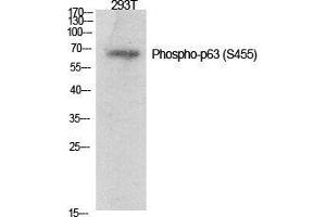 Western Blot (WB) analysis of specific cells using Phospho-p63 (S455) Polyclonal Antibody. (TCP1 alpha/CCTA anticorps  (pSer455))