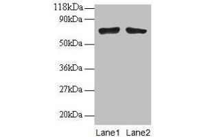 Western blot All lanes: BMI1 antibodyt 2 μg/mL Lane 1: EC109 whole cell lysate Lane 2: 293T whole cell lysate Secondary Goat polyclonal to rabbit IgG at 1/15000 dilution Predicted band size: 37 kDa Observed band size: 70 kDa (BMI1 anticorps  (AA 1-247))