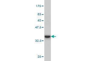 Western Blot detection against Immunogen (36. (IRAK3 anticorps  (AA 497-596))