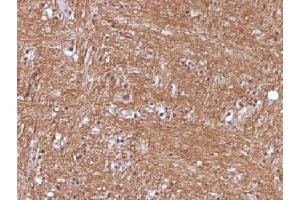 IHC testing of FFPE human cerebellum with NSE antibody (clone ENO2/1375).