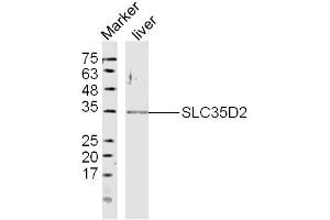 Mouse Liver lysates probed with SLC35D2 Polyclonal Antibody, Unconjugated  at 1:300 dilution and 4˚C overnight incubation. (Solute Carrier Family 35 (UDP-GlcNAc/UDP-Glucose Transporter), Member D2 (SLC35D2) (AA 251-326) anticorps)