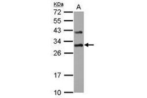 Image no. 3 for anti-Density-Regulated Protein (DENR) (AA 1-198) antibody (ABIN1501885)