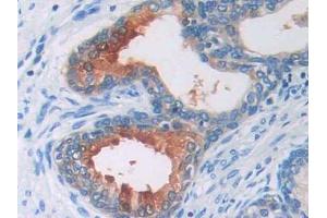 IHC-P analysis of Human Prostate Tissue, with DAB staining. (AGT anticorps  (AA 35-485))