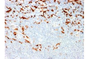 Formalin-fixed, paraffin-embedded human Lymph Node in Colon stained with CD163 Mouse Monoclonal Antibody (M130/2164). (CD163 anticorps  (AA 43-196))