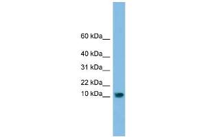 WB Suggested Anti-C13orf30 Antibody Titration: 0. (C13orf30 anticorps  (N-Term))
