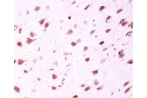 IHC-P Image MFN2 antibody [N1N2], N-term detects MFN2 protein at cytosol on mouse fore brain by immunohistochemical analysis.