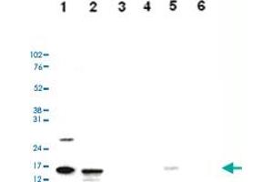 Western Blot analysis of (1) 25 ug whole cell extracts of Hela cells, (2) 15 ug histone extracts of Hela cells, (3) 1 ug of recombinant histone H2A, (4) 1 ug of recombinant histone H2B, (5) 1 ug of recombinant histone H3, (6) 1 ug of recombinant histone H4. (HIST1H3A anticorps  (acLys36))