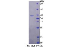 SDS-PAGE analysis of Rat USP1 Protein.