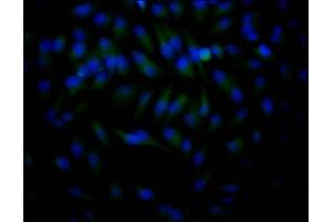 Immunofluorescence staining of Hela Cells with ABIN7127538 at 1:50, counter-stained with DAPI.