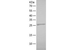 Western Blotting (WB) image for CCR4-NOT Transcription Complex, Subunit 8 (CNOT8) (AA 1-292) protein (His tag) (ABIN7122190)