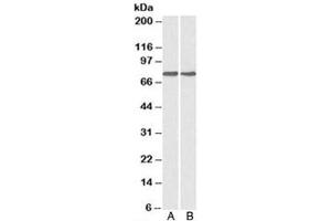Western blot testing of A) HepG2 and B) MCF7 cell lysate with GRP78 antibody at 0. (GRP78 anticorps)