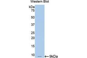 Western blot analysis of the recombinant protein. (Resistin anticorps  (AA 45-114))