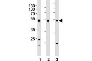 Western blot analysis of lysate from (1) HepG2, (2) HT-29, and (3) SW620 cell line using FOXA2 antibody at 1:1000. (FOXA2 anticorps  (C-Term))