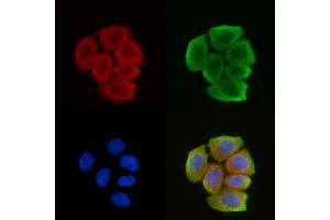 ABIN6259090 and ABIN6274229 staining Hela cells(30 min of UV treatment) by IF/ICC. (KAP1 anticorps  (Internal Region))