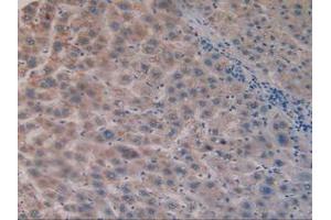 IHC-P analysis of Human Liver Tissue, with DAB staining. (CS anticorps  (AA 103-394))