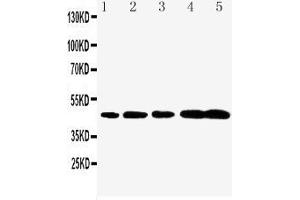Anti-Caspase-1(P20) antibody, Western blotting Lane 1: Rat Brain Tissue Lysate Lane 2: Rat Spleen Tissue Lysate Lane 3: Mouse Brain Tissue Lysate Lane 4: Mouse Spleen Tissue Lysate Lane 5: Mouse Testis Tissue Lysate