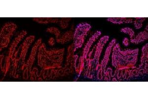 IF analysis of HMGB2 using anti-HMGB2 antibody (ABIN4886620). (HMGB2 anticorps  (N-Term))