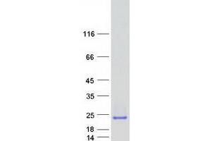 Validation with Western Blot