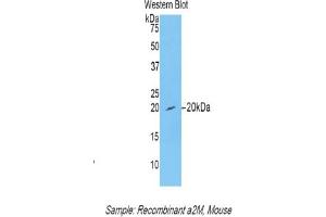 Western blot analysis of recombinant Mouse a2M. (alpha 2 Macroglobulin anticorps  (AA 1053-1214))