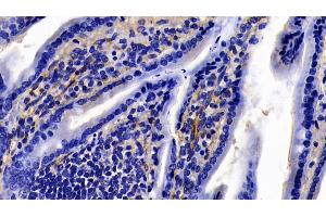 Detection of CAV1 in Mouse Colon Tissue using Polyclonal Antibody to Caveolin 1 (CAV1)