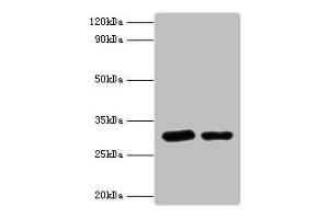 Western blot All lanes: Syntaxin-6 antibody at 2 μg/mL Lane 1: Mouse brain tissue Lane 2: 293T whole cell lysaye Secondary Goat polyclonal to rabbit IgG at 1/10000 dilution Predicted band size: 29 kDa Observed band size: 29 kDa (Syntaxin 6 anticorps  (AA 4-231))