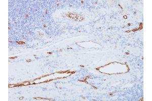 Formalin-fixed, paraffin-embedded human Tonsil stained with vWF Mouse Monoclonal Antibody (3E2D10).