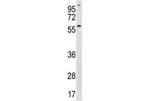 ETV5 antibody western blot analysis in A549 lysate (ETV5 anticorps  (AA 8-37))