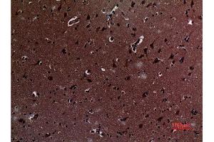 Immunohistochemistry (IHC) analysis of paraffin-embedded Human Brain, antibody was diluted at 1:100. (IL12A anticorps  (Internal Region))