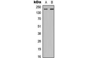Western blot analysis of CHD2 expression in HEK293T (A), A549 (B) whole cell lysates. (CHD2 anticorps  (Center))
