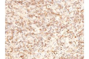 ABIN6267236 at 1/100 staining human appendiceal tissue sections by IHC-P. (MAP3K7 anticorps  (pThr187))