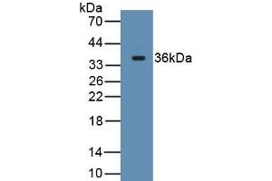 Detection of Recombinant CD163, Rat using Monoclonal Antibody to Cluster Of Differentiation (CD163)