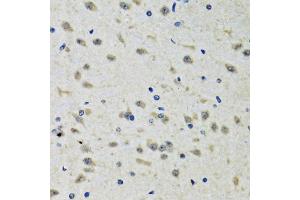 Immunohistochemistry of paraffin-embedded rat brain using CLIC1 antibody (ABIN2561895) at dilution of 1:100 (40x lens). (CLIC1 anticorps)