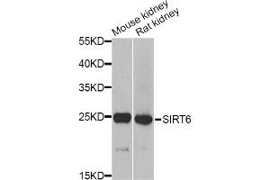 Western blot analysis of extracts of various cell lines, using MSRA Antibody. (MSRA anticorps)