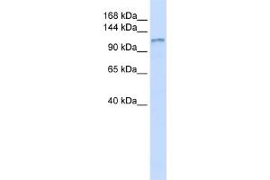 WB Suggested Anti-DGKH Antibody Titration:  0.