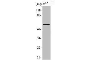 Western Blot analysis of HeLa cells using Phospho-Akt1 (S246) Polyclonal Antibody (AKT1 anticorps  (pSer246))