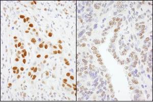 Immunohistochemistry (IHC) image for anti-General Transcription Factor III (GTF2I) (AA 935-985) antibody (ABIN7454739)