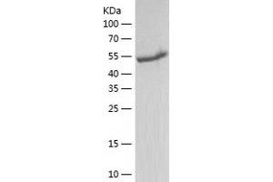 Western Blotting (WB) image for Aldehyde Dehydrogenase 5 Family, Member A1 (ALDH5A1) (AA 48-535) protein (His-IF2DI Tag) (ABIN7121776)