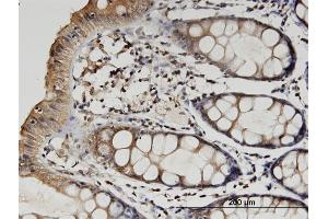 Immunoperoxidase of monoclonal antibody to TUBB2A on formalin-fixed paraffin-embedded human colon.