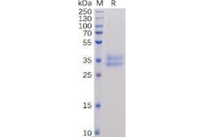 Human IL2RB Protein, His Tag on SDS-PAGE under reducing condition. (IL2 Receptor beta Protein (His tag))