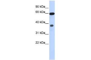 RCC2 antibody used at 1 ug/ml to detect target protein. (RCC2 anticorps  (Middle Region))