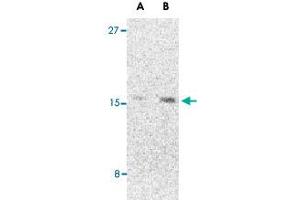 Western blot analysis of CBLN1 in 293 cell lysate with CBLN1 polyclonal antibody  at (A) 2 and (B) 4 ug/mL . (CBLN1 anticorps  (C-Term))