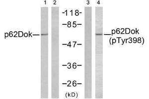 Western blot analysis of extracts from K562 cells, using p62Dok (Ab-398) antibody (E021269, Lane 1 and 2) and p62Dok (phospho-Tyr398) antibody (E011277, Lane 3 and 4). (DOK1 anticorps  (pTyr398))