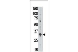 Antibody is used in Western blot to detect MAGEA3 in Jurkat lysate. (MAGEA3 anticorps  (C-Term))