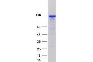Validation with Western Blot