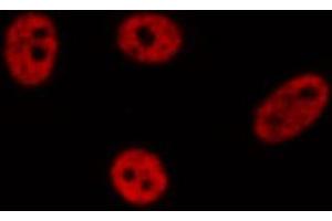 ABIN6272384 staining A549 by IF/ICC.