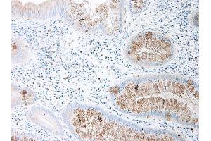 Image no. 1 for anti-Chemokine (C-C Motif) Ligand 15 (CCL15) antibody (ABIN464833)