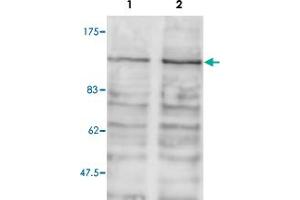 Western blot was performed on whole cell lysates from mouse fibroblasts (Lane 1, NIH/3T3) and embryonic stem cells (Lane 2, E14Tg2a) with Brd2 polyclonal antibody , diluted 1 : 1,000 in BSA/PBS-Tween. (BRD2 anticorps)